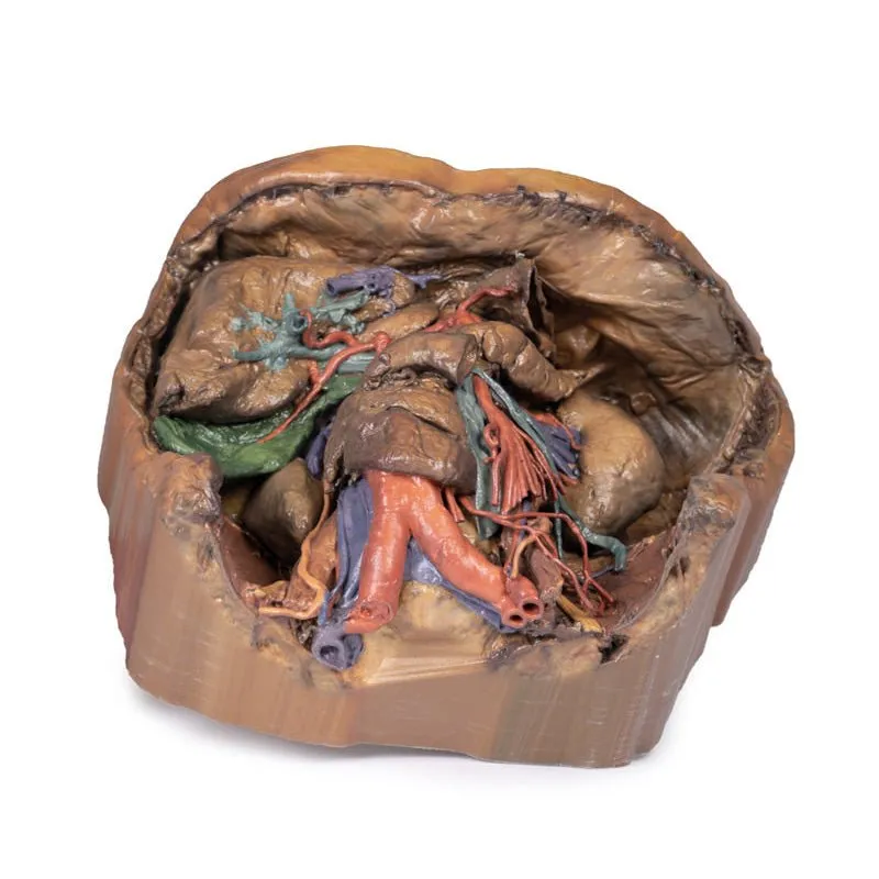 3D Printed Abdomen Vasculature